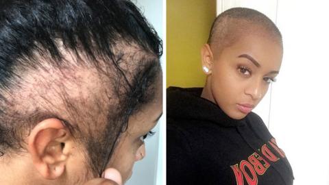 Paigey Cakey before her transplant and immediately after