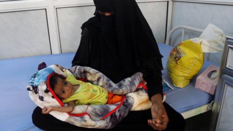 A Yemeni woman with a malnourished child at a hospital in Hudaydah, 7 May 2018