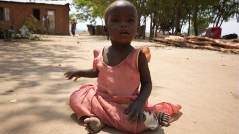 Child in Malawi