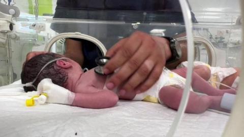 A baby in an incubator is attended to by a medical workers