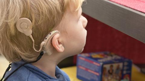 Cochlear implants