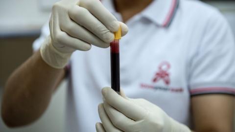 A person holding a vial of blood