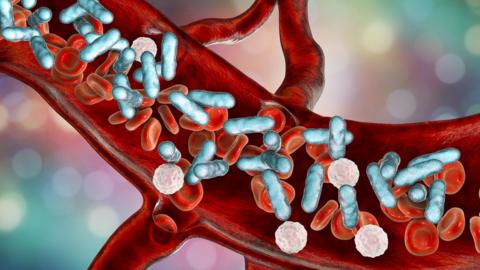 Bacteria entering the bloodstream during sepsis