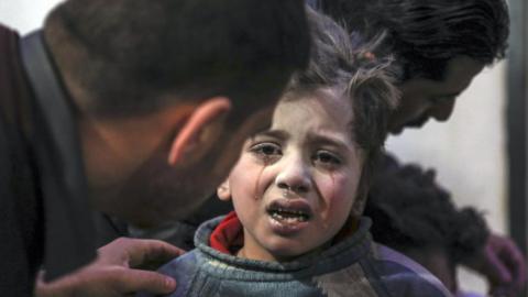 An injured child is treated at a hospital in the rebel-held Eastern Ghouta on 19 February 2018