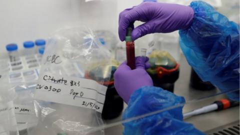 Blood samples from patients infected with the coronavirus disease (COVID-19) are prepared for analysis in a Blood Processing Lab in Cambridge