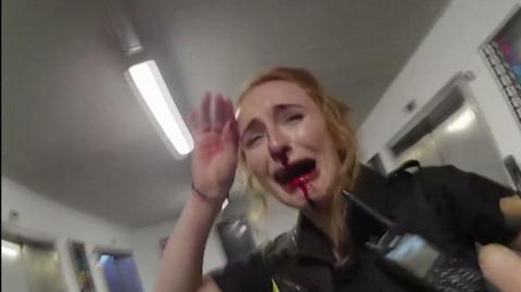 A police officer with a broken and bloody nose is crying and holding a hand to her face