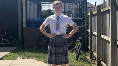 Oliver in the checked skirt