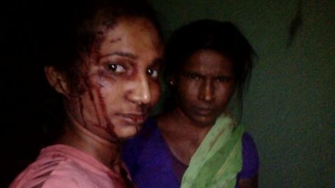 Rupali Mesharam and her mother soon after the attack