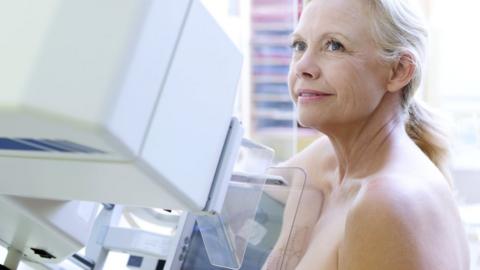 Older woman having a mammogram