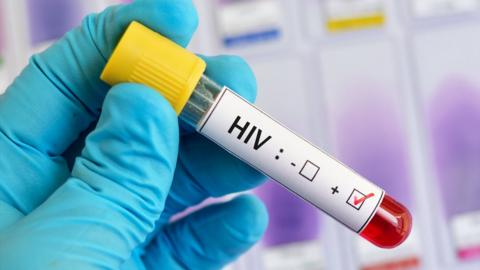 HIV-positive blood