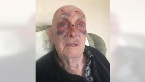 84-year-old John Miller after he was hit by an illegal bike