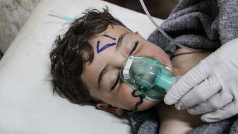 A Syrian child receives treatment at a field hospital in Saraqeb after an alleged chemical attack in Khan Sheikhoun (4 April 2017)