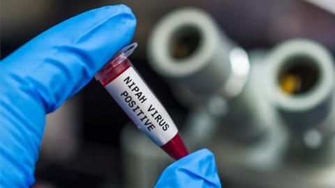 Nipah virus positive blood sample - stock photo