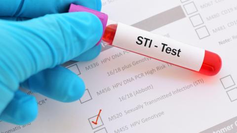 A stock photo of a hand wearing blue medical gloves, holding a small test tube with a red substance in it. A white label on the bottle reads 'STI - Test'. Underneath the hand is a white form with a box on it ticked against the 'Sexually Transmitted Infection' box.