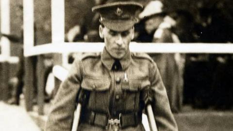 The injuries Thomas Hughes suffered at the Somme meant he never walked properly again