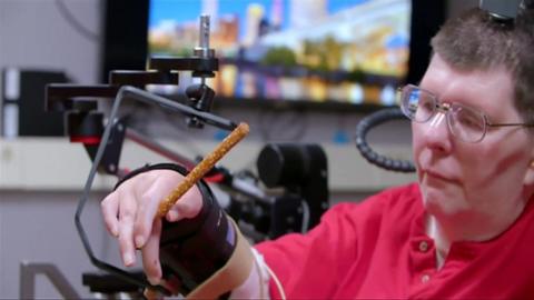 Bill Kochevar was paralysed from the shoulders down in a bicycle accident, but neuroprosthesis means he can feed himself again.