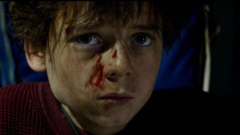 Alfie Williams is dressed as his character Spike from 28 Years Later: The Bone Temple. He looks directly into camera, and appears to be injured with blood on his face. 
