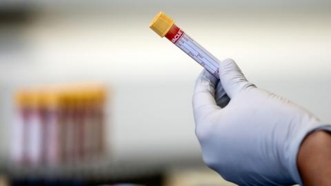 A blood sample in a test tube being held up by a hand with a white glove. 
