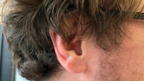 A close up of a person's ear. They have short brown hair and black glasses.