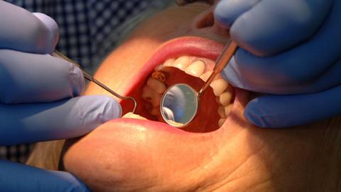 A dentist checking condition of a patient's teeth. The patient has their mouth open while the dentist uses instruments to inspect their teeth.