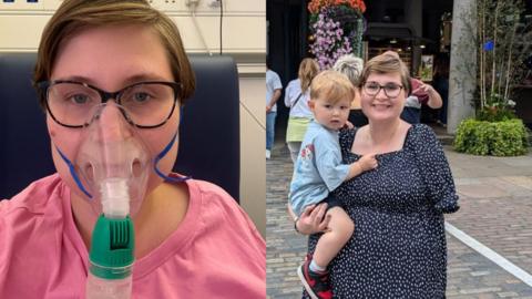 Two photos side by side. The photo on the left shows a woman sitting in a hospital chair wearing a pair of glasses and an oxygen mask. The photo on the right shows the same woman after she had her arm amputated, smiling and holding a toddler.