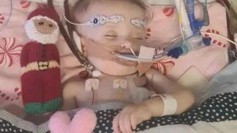 A toddler lies in a hospital bed linked up to tubes. She is sleeping. A small Father Christmas cuddly toy lies on the bed next to her.