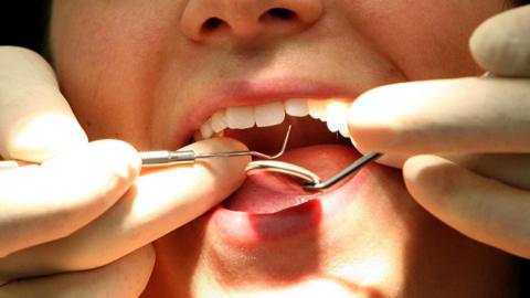 A close-up image of hands putting dental tools into someone's open mouth.