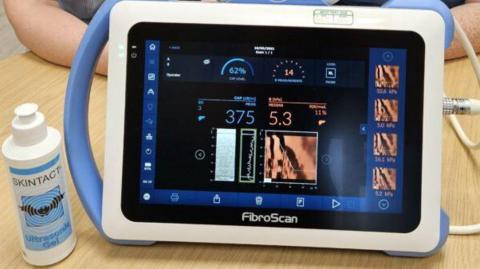 The screen of a Fibroscan machine used to detect liver problems. The black screen is showing a range of data using numbers and graphs. The text on the screen is coloured blue and orange. The machine itself is white tablet with cables running out of it and it is standing on a light wooden table top.