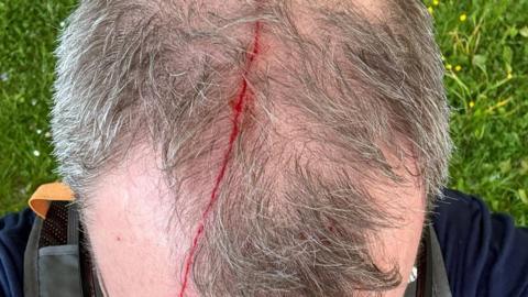 A man's head with a big scratch down the middle.