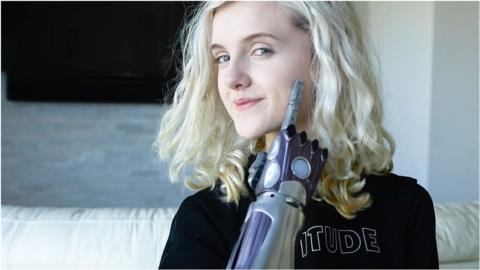 Tilly Lockey, who lost her hands to meningitis, is trying to inspire others during the lockdown.