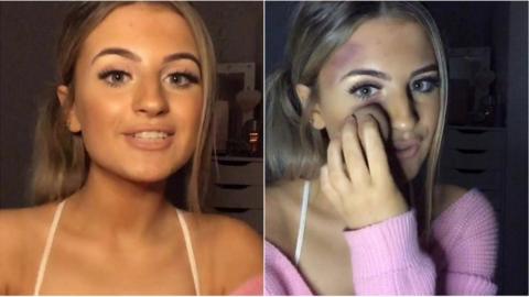 Amber Butt before and after applying make up to make it look as if her face is covered in bruises