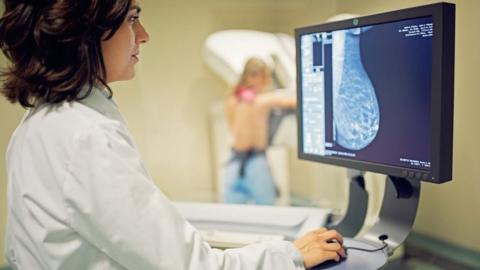 A breast cancer scan