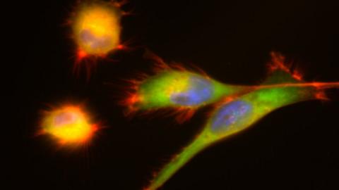 Image showing the adhesions (green) of less adherent and migrating metastatic cancer cells