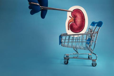 Artwork featuring a kidney in a shopping trolley and a surgeon's hand