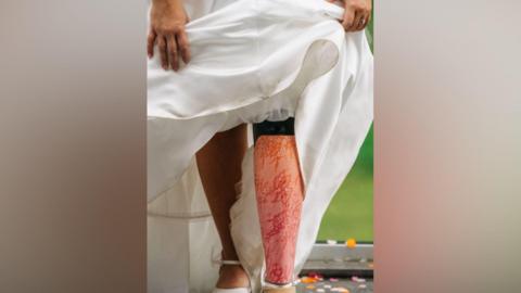 A bride holds up her wedding dress to show a prosthetic leg decorated with a pink and orange floral pattern. Only the bottom half of the bride can be seen. There is confetti on the ground behind her.