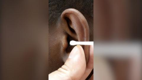 A boys ear is held by the finger of a doctor who is positioning a cotton bud near the ear canal.