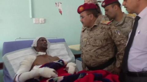 Yemeni military commander visits a soldier injured in the missile attack on a military camp in Marib province