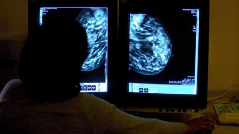 Silhouette of a consultant looking at a screen showing a mammogram. 