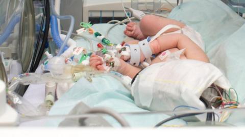 Baby in intensive neonatal care