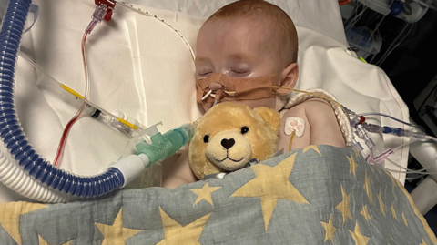 Baby asleep in hospital bed surrounded by tubes and wires - and a teddy bear