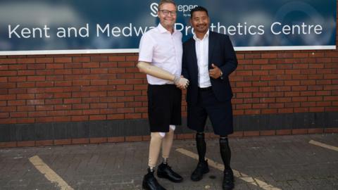 Two men with prosthetic limbs shake hands.