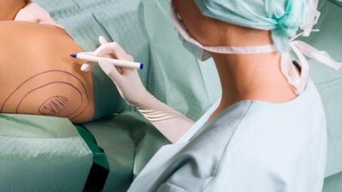 A female surgeon about to carry out liposuction