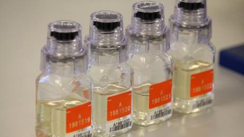 Urine samples, file pic