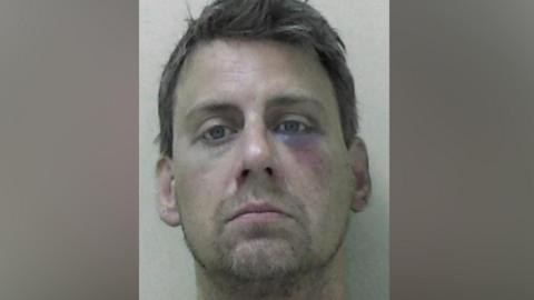 Mugshot of Benjamin Ypma. He has a short scruffy goatee and thick black hair. He has a large bruise under his left eye.