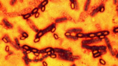 A microscopic picture of spores and vegetative cells of Bacillus anthracis which causes the disease anthrax