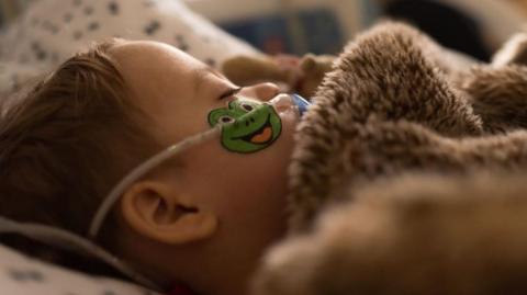 A toddler with brown hair is lying in a bed with a fluffy brown duvet recovering from RSV. He is sleeping and has a blue dummy in his mouth as well as a clear tube going across his face which has a frog sticker on it where his cheek is.