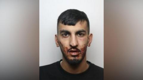 A man in his twenties with short dark hair and blood across his cheeks and chin.