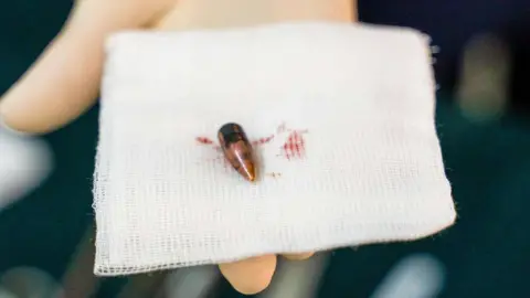 A bullet removed from a wounded person
