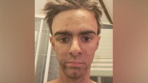 A selfie style image of a young man with dirt all over his face.