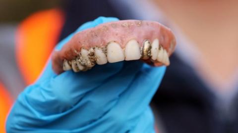 False teeth being held by gloved hand